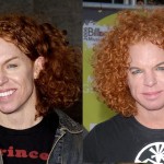 Scott Thompson before and after plastic surgery
