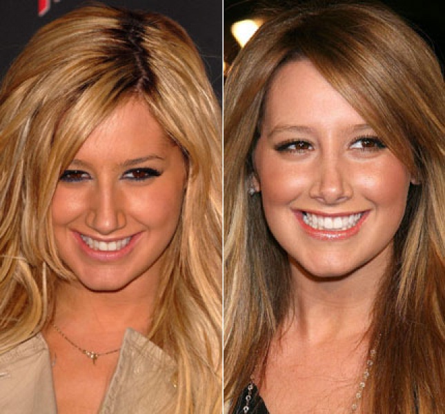 ashley tisdale nose job before and after.