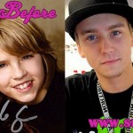 blake and dylan tuomy-wilhoit before and after