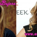 candace cameron plastic surgery