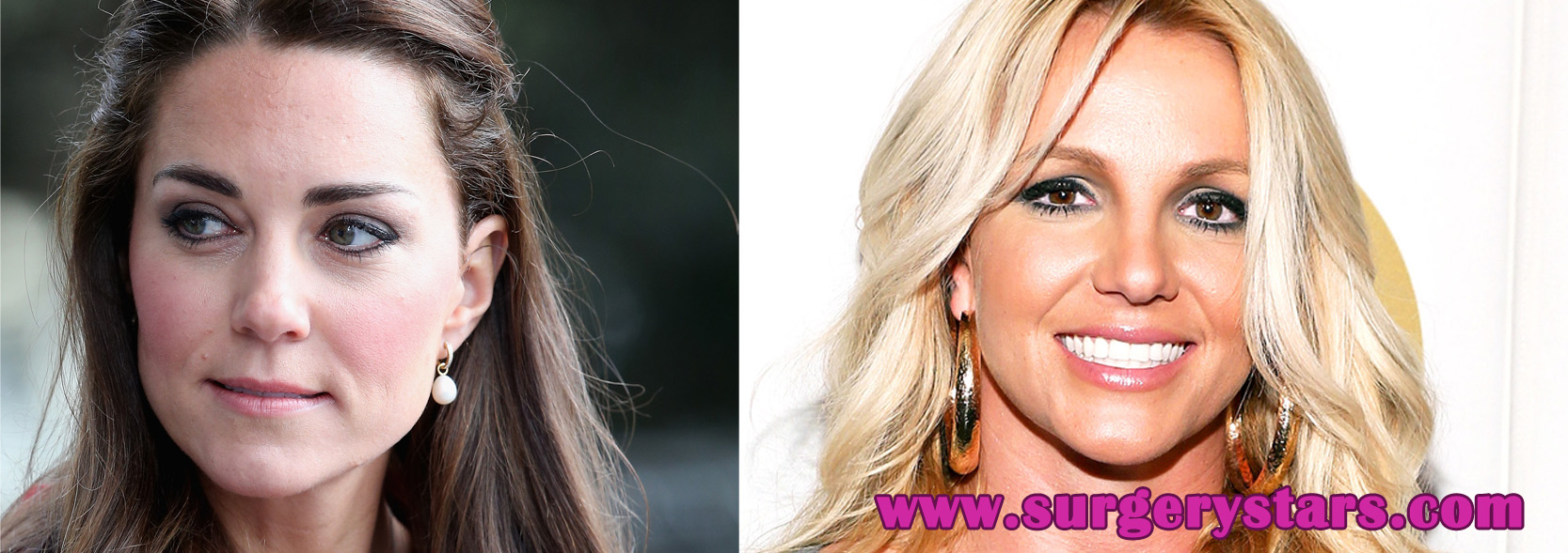 celebrity before and after plastic surgery (10 celebs)