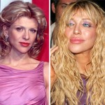 courtney love before and after plastic surgery