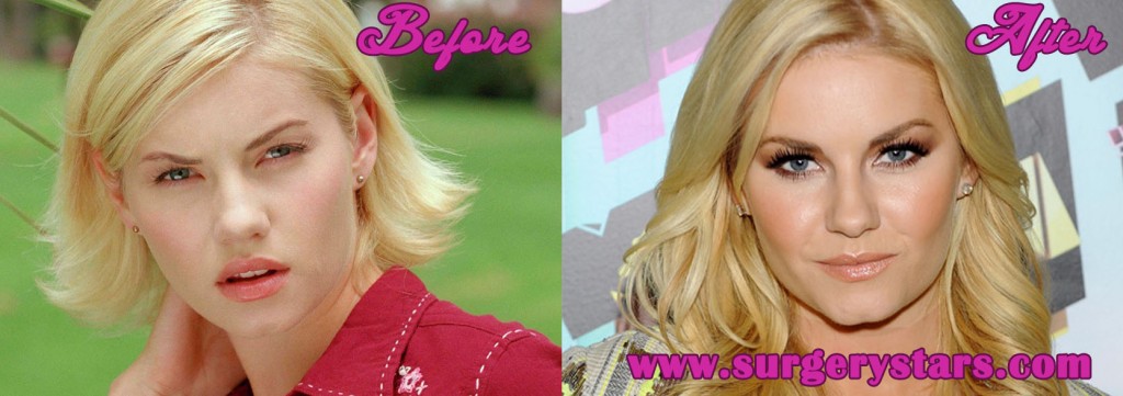 elisha cuthbert plastic surgery