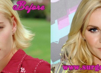 elisha cuthbert plastic surgery