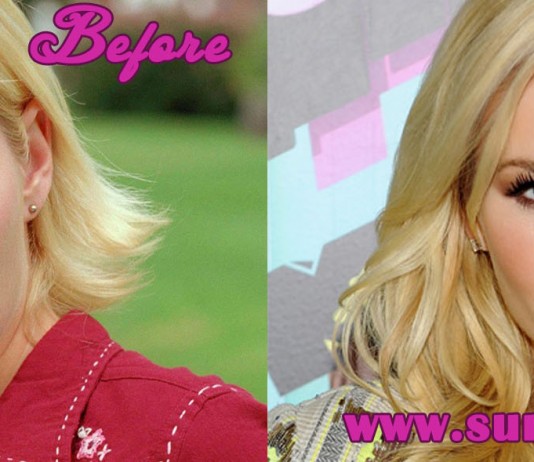 elisha cuthbert plastic surgery