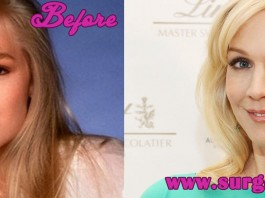 Jennie Garth Plastic Surgery
