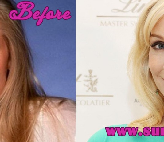 Jennie Garth Plastic Surgery