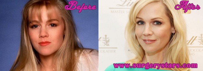 Jennie Garth Plastic Surgery