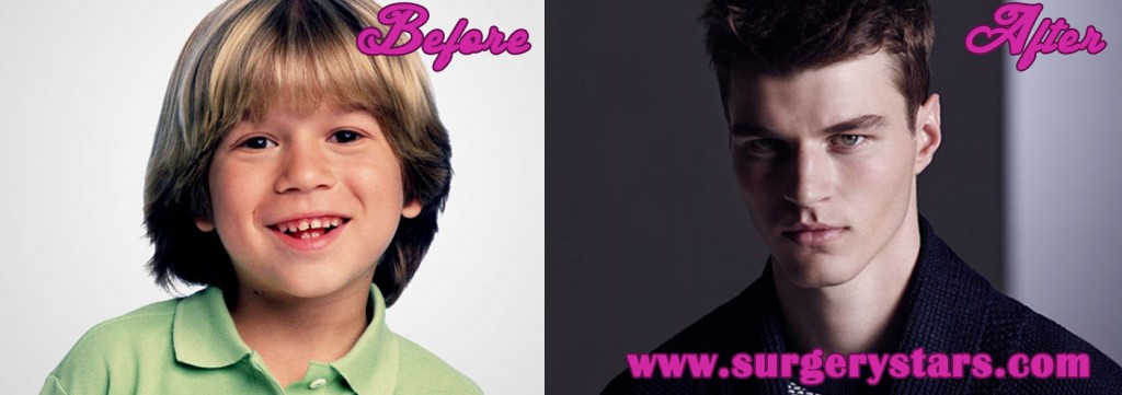 justin cooper before anda after