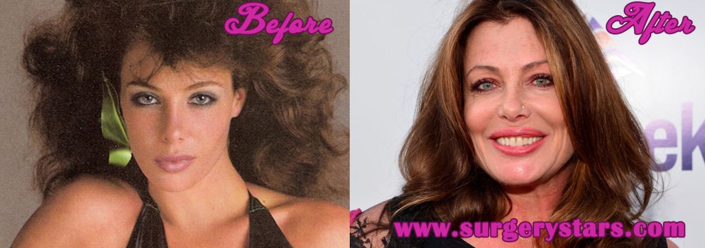 kelly lebrock plastic surgery