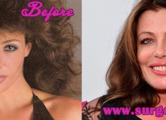 kelly lebrock plastic surgery