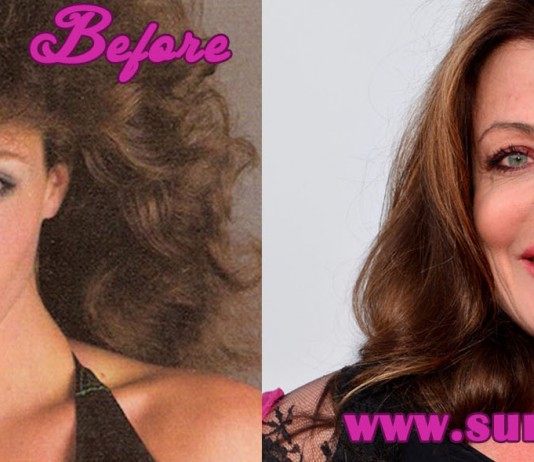 kelly lebrock plastic surgery