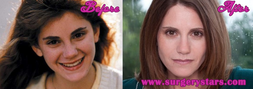 kerri green before and after