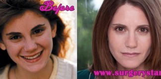 kerri green before and after