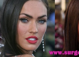 megan fox acne scars