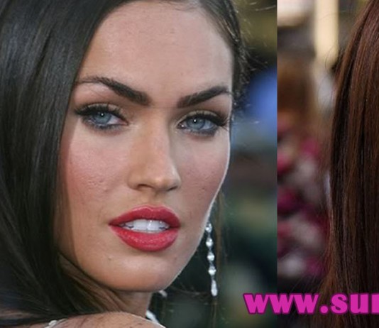 megan fox acne scars