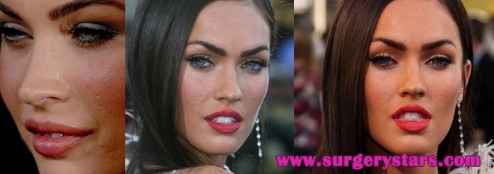 megan fox acne scars