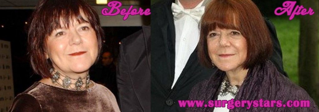 rima horton before and after