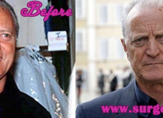 santo versace before and after