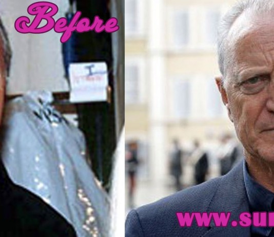 santo versace before and after