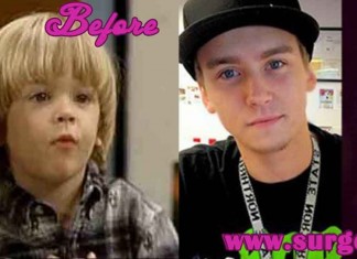 Blake and Dylan Tuomy-wilhoit Before and After Pictures