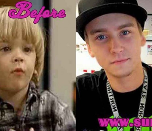 Blake and Dylan Tuomy-wilhoit Before and After Pictures