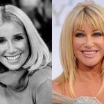 suzanne somers before and after plastic surgery