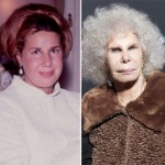 the duchess of alba before and after