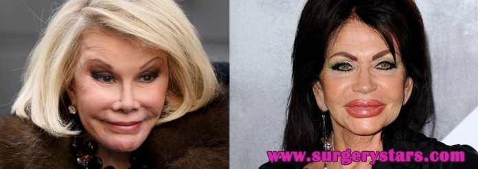 Worst Celebrity Plastic Surgery