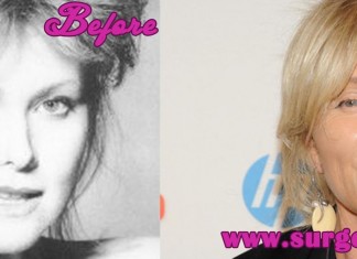 Deborra-Lee Furness before and After Photos