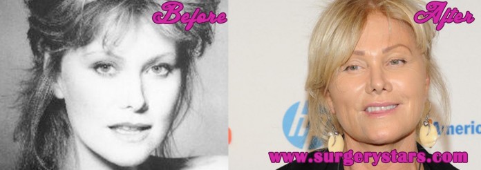 Deborra-Lee Furness before and After Photos