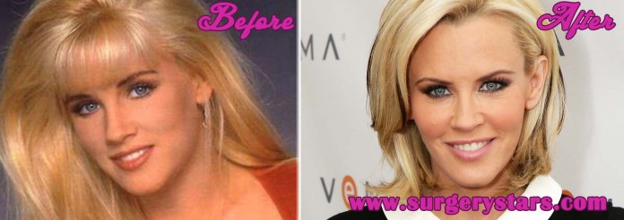 Jenny Mccarthy Plastic Surgery