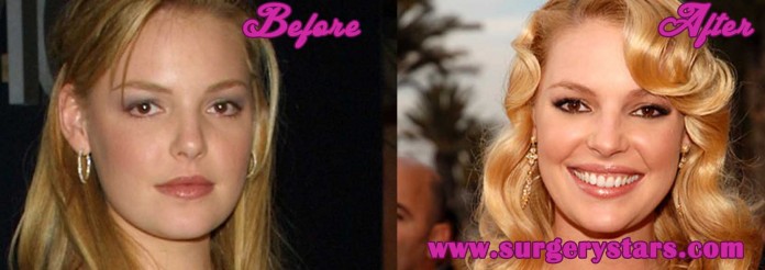 Katherine Heigl Plastic Surgery