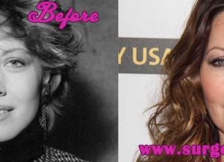 Linda Kozlowski Plastic Surgery