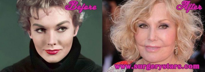 kim Novak plastic surgery