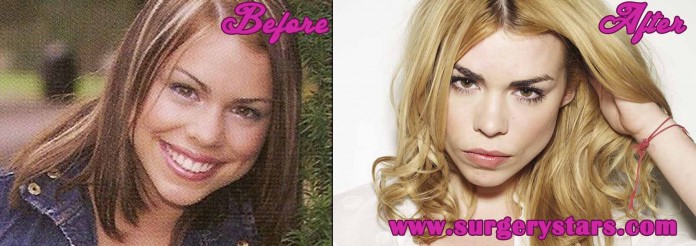 Billie Piper Plastic Surgery l