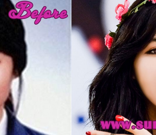 Hyuna Plastic Surgery