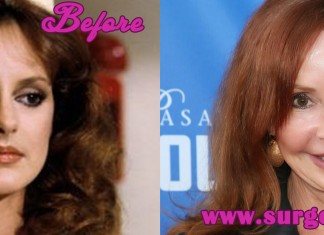 Jackie Zeman Plastic Surgery