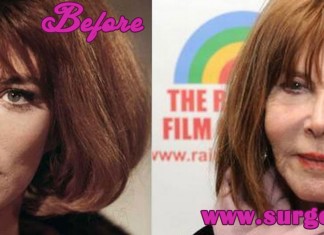 Lee Grant plastic surgery