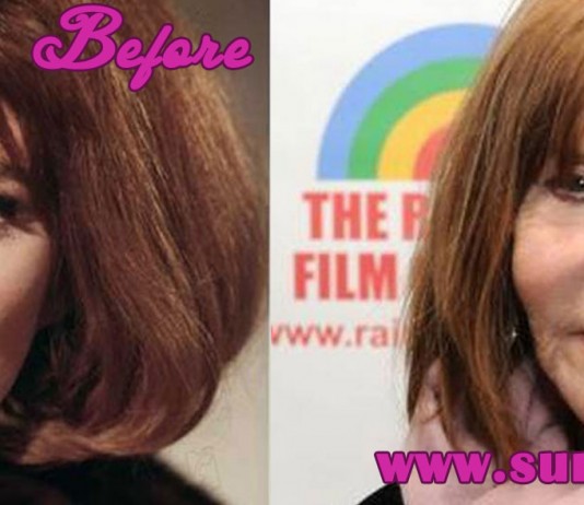 Lee Grant plastic surgery