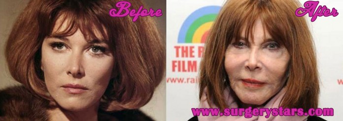 Lee Grant plastic surgery