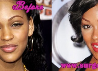 Meagan Good Plastic Surgery