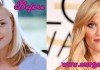 Reese Witherspoon Plastic Surgery