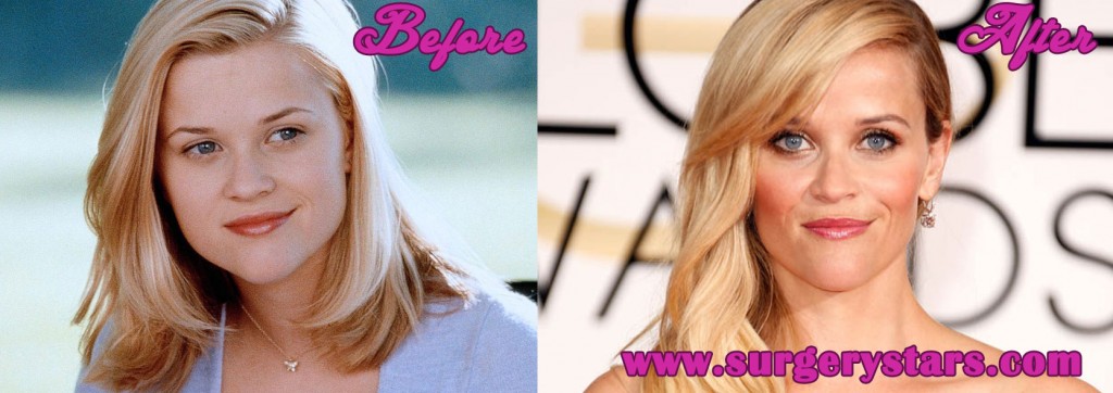 Reese Witherspoon Plastic Surgery Before And After Picture