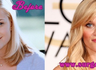 Reese Witherspoon Plastic Surgery