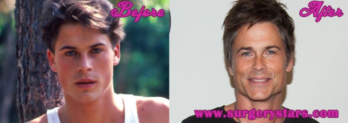 Rob Lowe Plastic Surgery