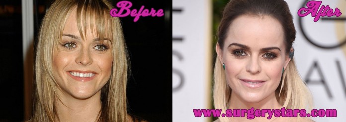 Taryn Manning Plastic Surgery