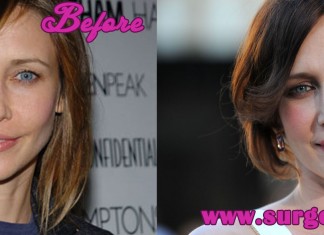 Vera Farmiga Plastic Surgery