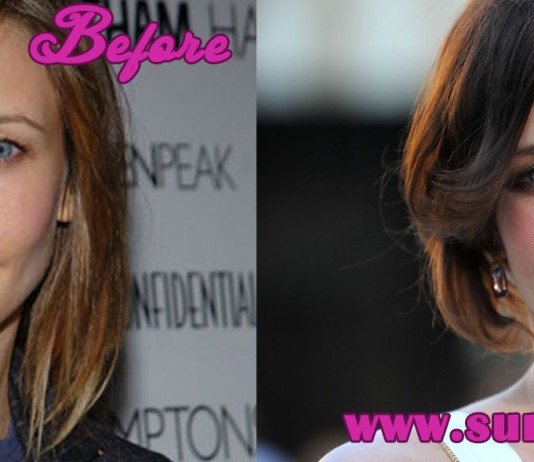 Vera Farmiga Plastic Surgery