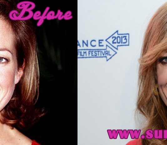 Allison Janney Plastic Surgery